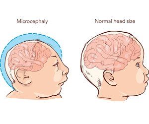 Kids Brain Graph