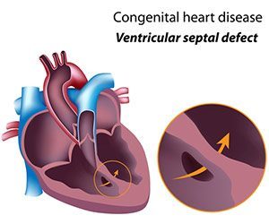 Heart Image