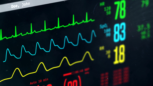 Equipo de anestesia y monitores quirúrgicos en una sala de operaciones