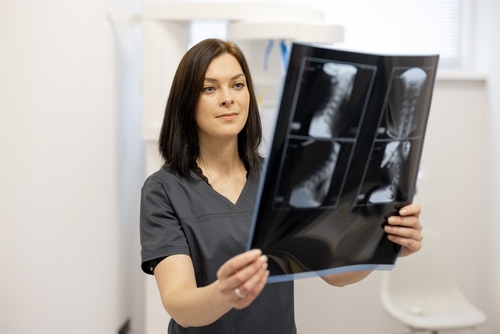 Pediatric spinal X-ray for birth injury nerve damage page