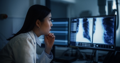 Radiologist reviewing chest X-rays on medical monitors