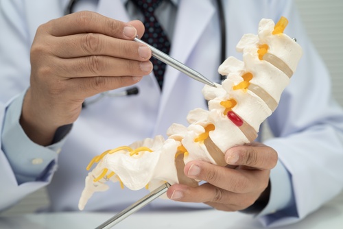 Doctor explaining spinal cord injury with anatomical spine model